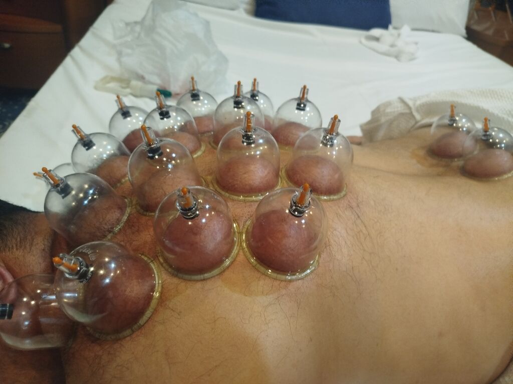 Peşəkar Müalicəvi Masaj Xidməti - 2