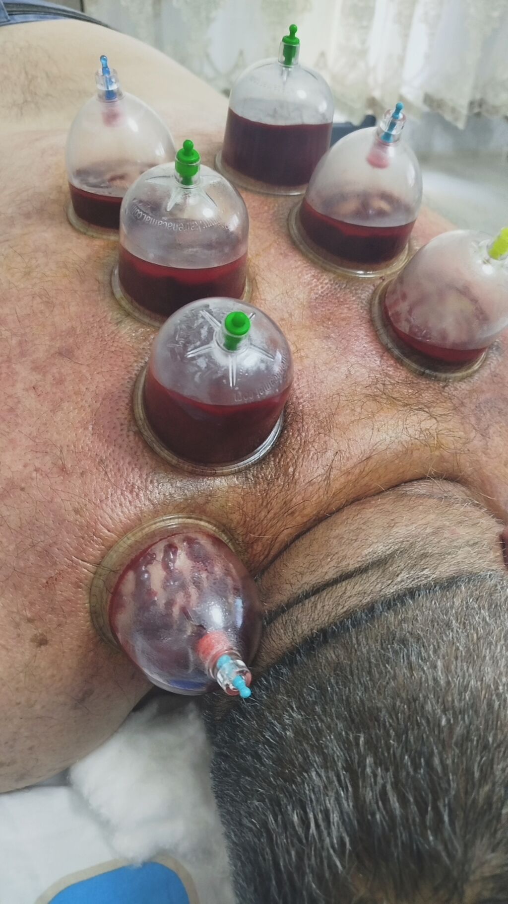 Peşəkar Müalicəvi Masaj Xidməti - 4