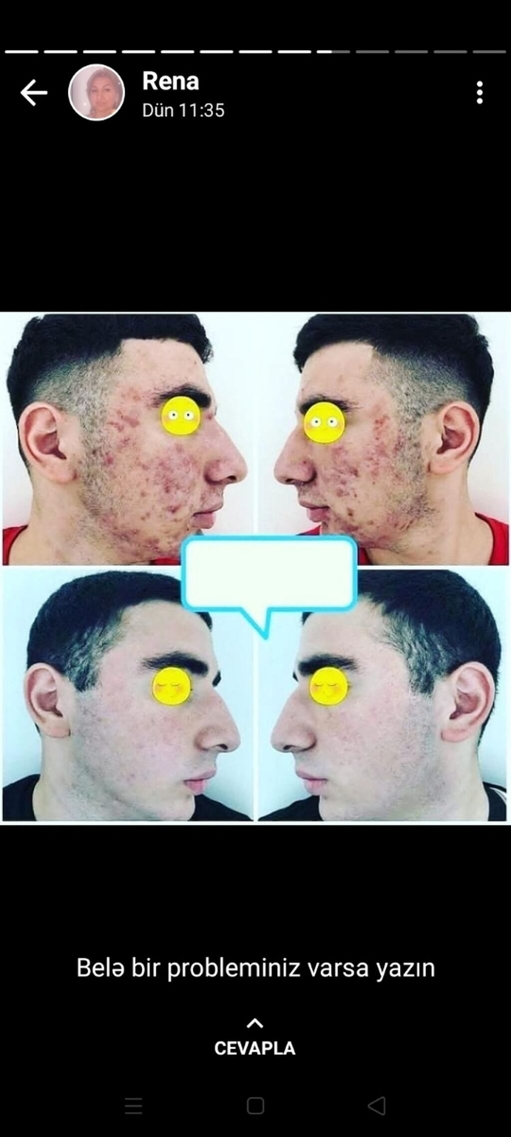 Deri və saç problemlərinin müalicəsi - 3