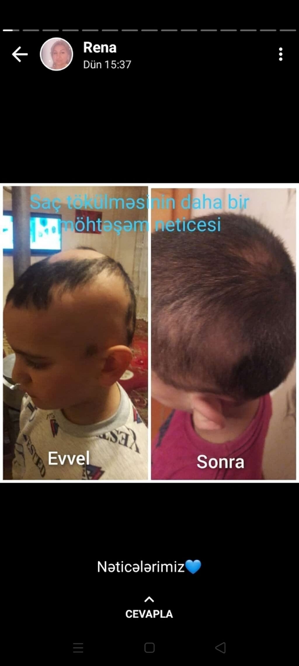 Deri və saç problemlərinin müalicəsi - 5