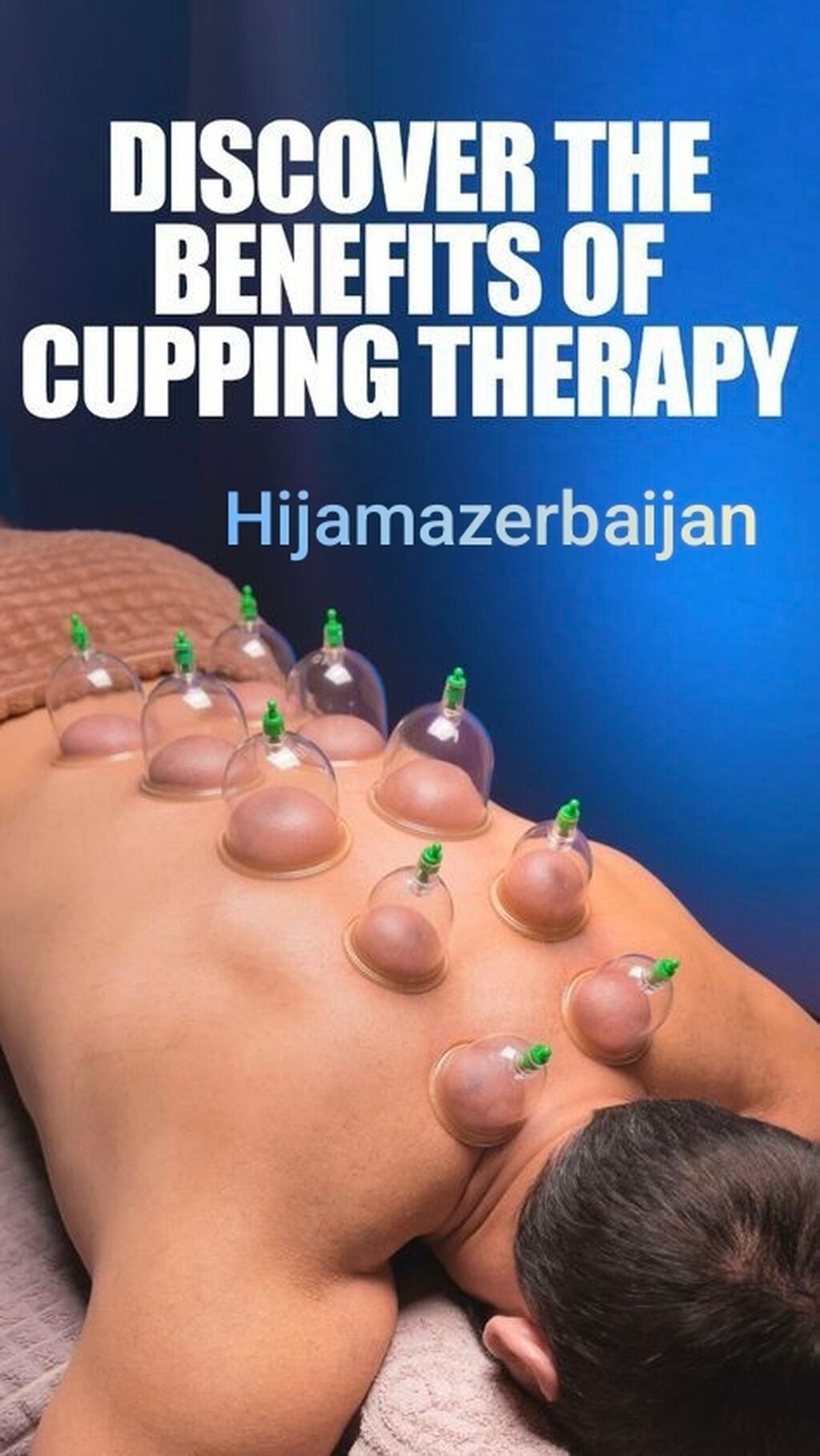 Hijama Həccəm xidməti - 5